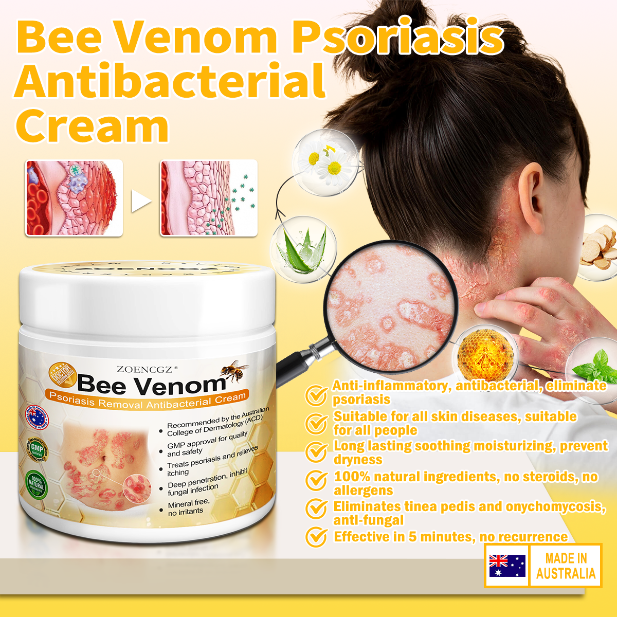👩‍⚕️👩‍⚕️𝐙𝐨𝐞𝐧𝐜𝐠𝐳™ 𝐁𝐞𝐞 𝐕𝐞𝐧𝐨𝐦 𝐏𝐬𝐨𝐫𝐢𝐚𝐬𝐢𝐬 𝐑𝐞𝐥𝐢𝐞𝐟 𝐀𝐧𝐭𝐢𝐛𝐚𝐜𝐭𝐞𝐫𝐢𝐚𝐥 𝐂𝐫𝐞𝐚𝐦 (🏅𝐀𝐂𝐃 𝐑𝐞𝐜𝐨𝐦𝐦𝐞𝐧𝐝𝐞𝐝🏅)