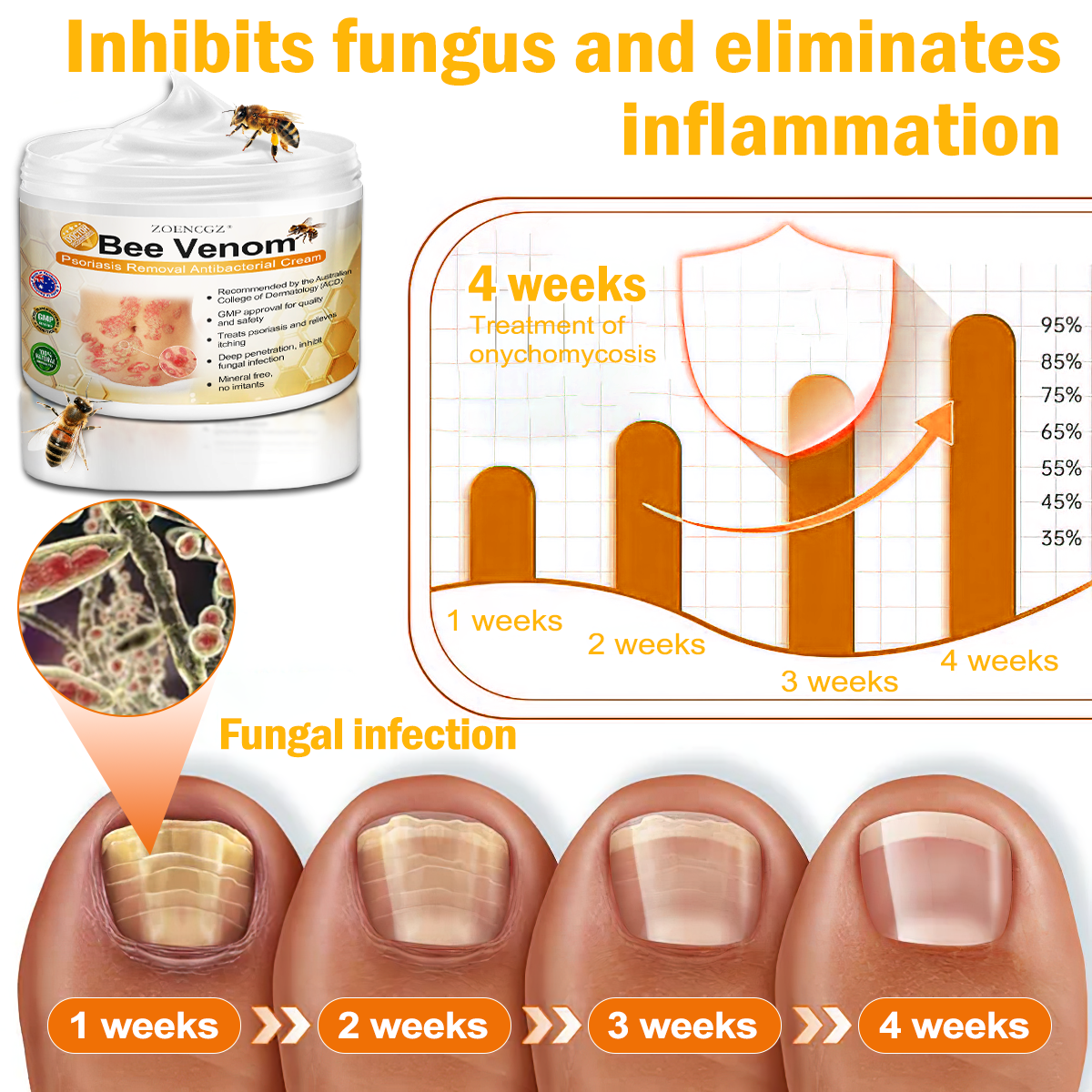 👩‍⚕️👩‍⚕️𝐙𝐨𝐞𝐧𝐜𝐠𝐳™ 𝐁𝐞𝐞 𝐕𝐞𝐧𝐨𝐦 𝐏𝐬𝐨𝐫𝐢𝐚𝐬𝐢𝐬 𝐑𝐞𝐥𝐢𝐞𝐟 𝐀𝐧𝐭𝐢𝐛𝐚𝐜𝐭𝐞𝐫𝐢𝐚𝐥 𝐂𝐫𝐞𝐚𝐦 (🏅𝐀𝐂𝐃 𝐑𝐞𝐜𝐨𝐦𝐦𝐞𝐧𝐝𝐞𝐝🏅)