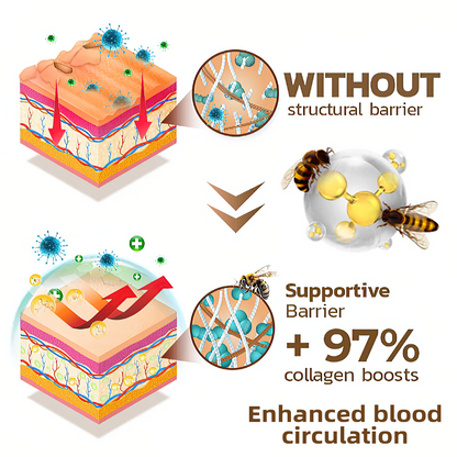 👩‍⚕️👩‍⚕️𝐙𝐨𝐞𝐧𝐜𝐠𝐳™ 𝐁𝐞𝐞 𝐕𝐞𝐧𝐨𝐦 𝐏𝐬𝐨𝐫𝐢𝐚𝐬𝐢𝐬 𝐑𝐞𝐥𝐢𝐞𝐟 𝐀𝐧𝐭𝐢𝐛𝐚𝐜𝐭𝐞𝐫𝐢𝐚𝐥 𝐂𝐫𝐞𝐚𝐦 (🏅𝐀𝐂𝐃 𝐑𝐞𝐜𝐨𝐦𝐦𝐞𝐧𝐝𝐞𝐝🏅)