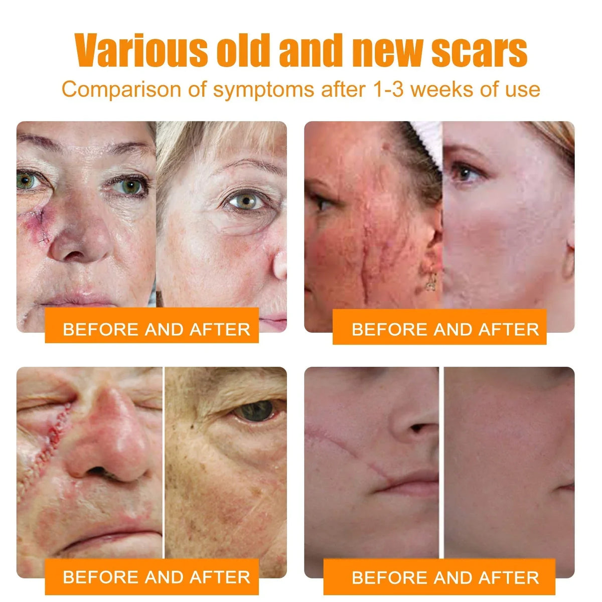 👩‍⚕️👩‍⚕️𝐙𝐨𝐞𝐧𝐜𝐠𝐳™ 𝐁𝐞𝐞 𝐕𝐞𝐧𝐨𝐦 𝐏𝐬𝐨𝐫𝐢𝐚𝐬𝐢𝐬 𝐑𝐞𝐥𝐢𝐞𝐟 𝐀𝐧𝐭𝐢𝐛𝐚𝐜𝐭𝐞𝐫𝐢𝐚𝐥 𝐂𝐫𝐞𝐚𝐦 (🏅𝐀𝐂𝐃 𝐑𝐞𝐜𝐨𝐦𝐦𝐞𝐧𝐝𝐞𝐝🏅)