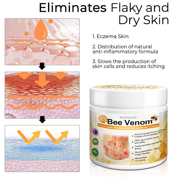 👩‍⚕️👩‍⚕️𝐙𝐨𝐞𝐧𝐜𝐠𝐳™ 𝐁𝐞𝐞 𝐕𝐞𝐧𝐨𝐦 𝐏𝐬𝐨𝐫𝐢𝐚𝐬𝐢𝐬 𝐑𝐞𝐥𝐢𝐞𝐟 𝐀𝐧𝐭𝐢𝐛𝐚𝐜𝐭𝐞𝐫𝐢𝐚𝐥 𝐂𝐫𝐞𝐚𝐦 (🏅𝐀𝐂𝐃 𝐑𝐞𝐜𝐨𝐦𝐦𝐞𝐧𝐝𝐞𝐝🏅)