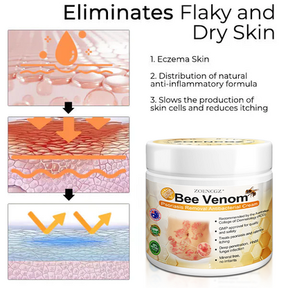 👩‍⚕️👩‍⚕️𝐙𝐨𝐞𝐧𝐜𝐠𝐳™ 𝐁𝐞𝐞 𝐕𝐞𝐧𝐨𝐦 𝐏𝐬𝐨𝐫𝐢𝐚𝐬𝐢𝐬 𝐑𝐞𝐥𝐢𝐞𝐟 𝐀𝐧𝐭𝐢𝐛𝐚𝐜𝐭𝐞𝐫𝐢𝐚𝐥 𝐂𝐫𝐞𝐚𝐦 (🏅𝐀𝐂𝐃 𝐑𝐞𝐜𝐨𝐦𝐦𝐞𝐧𝐝𝐞𝐝🏅)